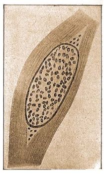 Egy sprslnynek, a Myxobolus pfeifferinek (Thlohan) a mrna hsban kpezett tokja telve sprk ezreivel